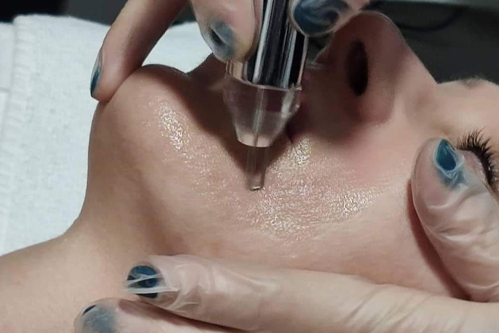 ES Estética (8)